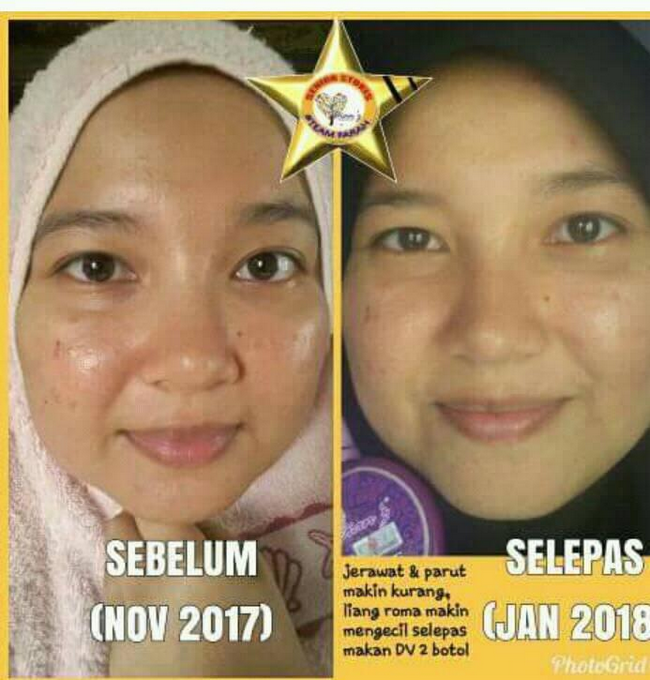 Rawat Kulit Muka Kusam dan Kulit Kering Kembali Cerah Bermaya