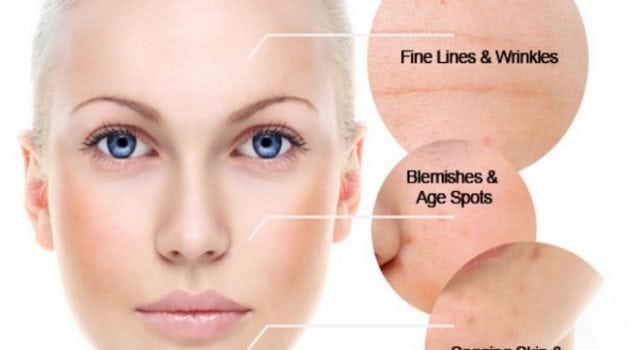 Cegah Kulit Sunburn Dan Cara Untuk Mendapatkan Kulit Putih 