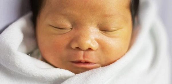 penyakit jaundis bayi baru lahir