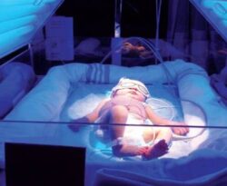 Check Kuning Bayi Tanpa Jarum di Subang Jaya – Klinik Nur Medicare